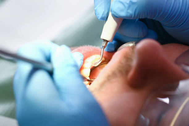 Best Emergency Dentist for Lost Fillings or Crowns in Mount Ora, OH