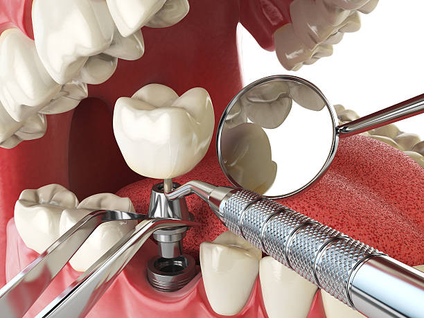 Best Orthodontic Emergency Dentist in Mount Ora, OH